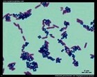 Klebsiella pneumoniae and Staphylococcus aureus microscopy